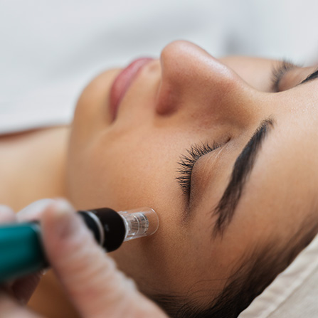 Procell Therapies Skin Needling